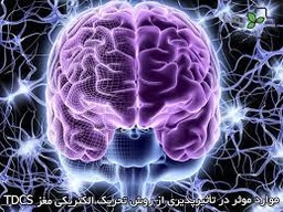 تحریک الکتریکی مغز
